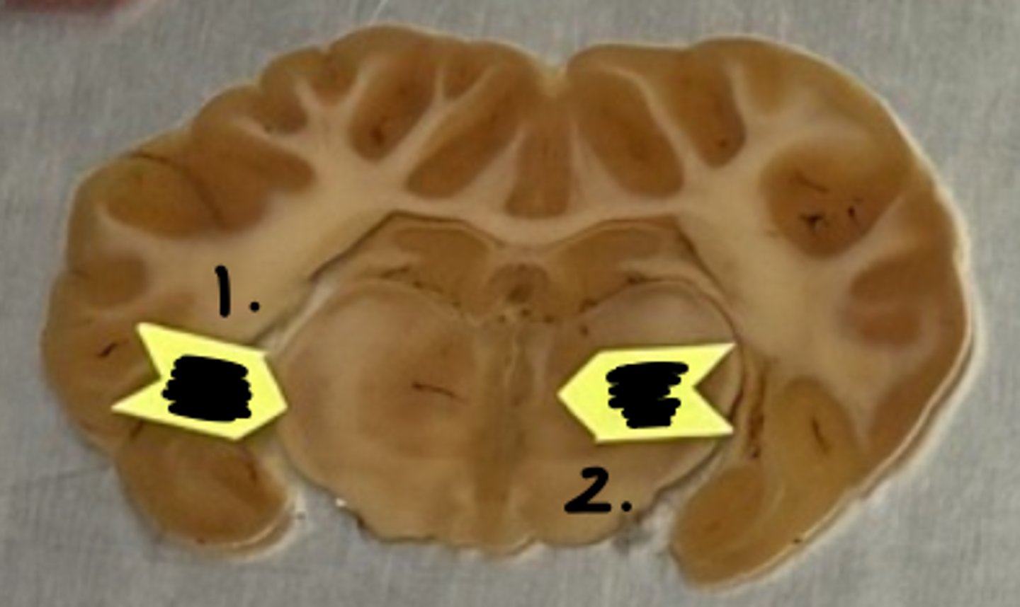 <p>what structure is labeled as #2 ?</p>