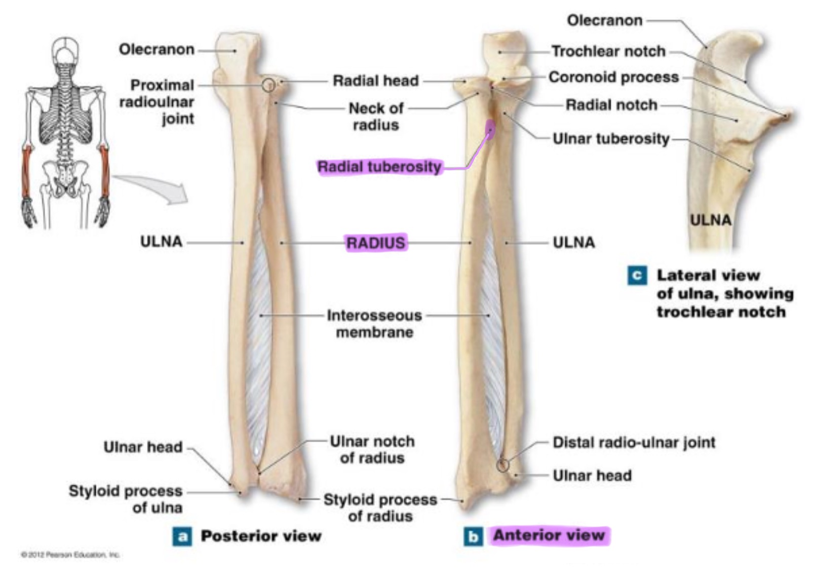<p>rough projection just below the neck of the radius on the medial side; serves as attachment point for biceps brachii muscle</p>