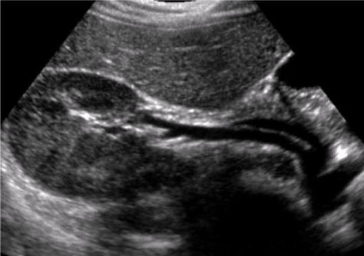 <p>What does this trans image demonstrate?</p>