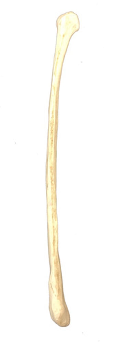 <p>Identify this bone.</p>