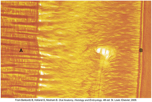 <p><span>Entrapped collagen fiber bundles in cementum or bone. The fibers of the PDL are embedded in the cementum on one end and the alveolar bone on the other end. These embedded potions become mineralized and are called ______.</span></p>