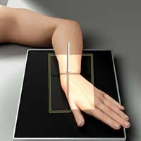 <p>Place the image receptor on a 20° angle sponge, wrist in PA with ulnar deviation.</p><p></p><p>Wrist flat on IR in PA with ulnar deviation.</p><p></p><p>(notice only the IR positioning changes)</p>