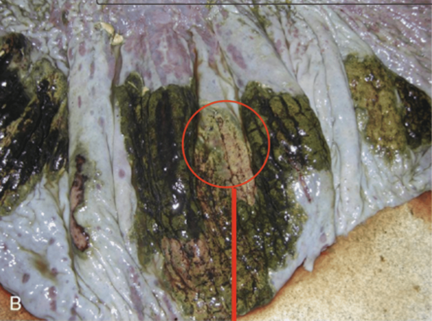 <p>¿patología morfológica?</p>