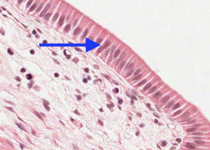 <p><span><strong>The clear space (arrowed; X20) between the cells lining the gallbladder hint at the functional role of the gallbladder i.e.</strong></span></p>