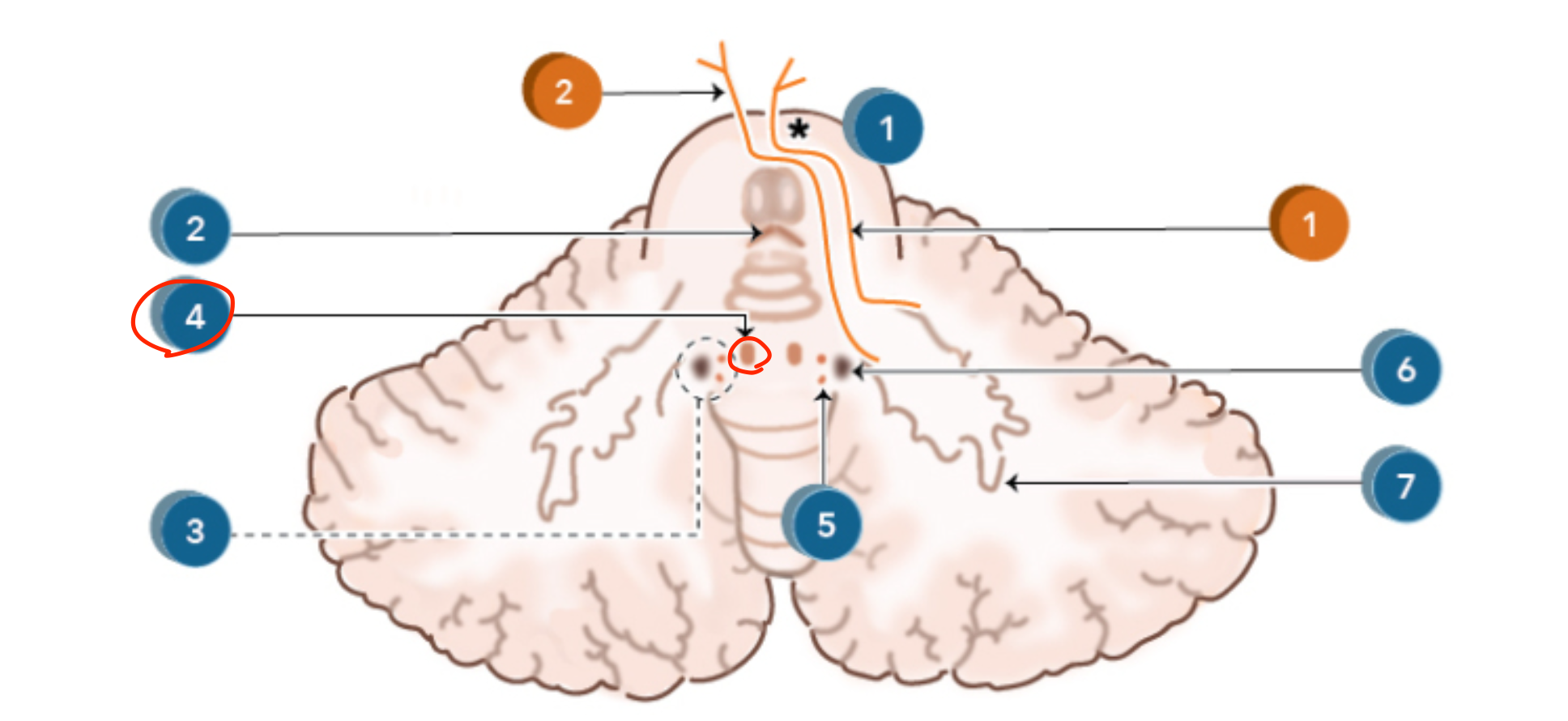 <p>Fastigial nucleus</p>