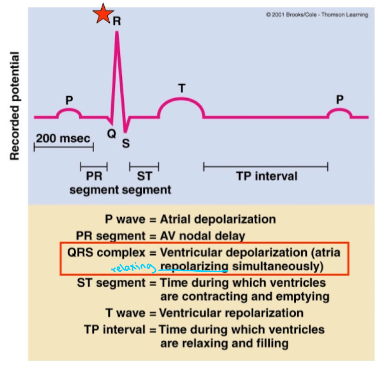 <p>Ventricular depolarization (atria repolarizing simultaneously)</p>