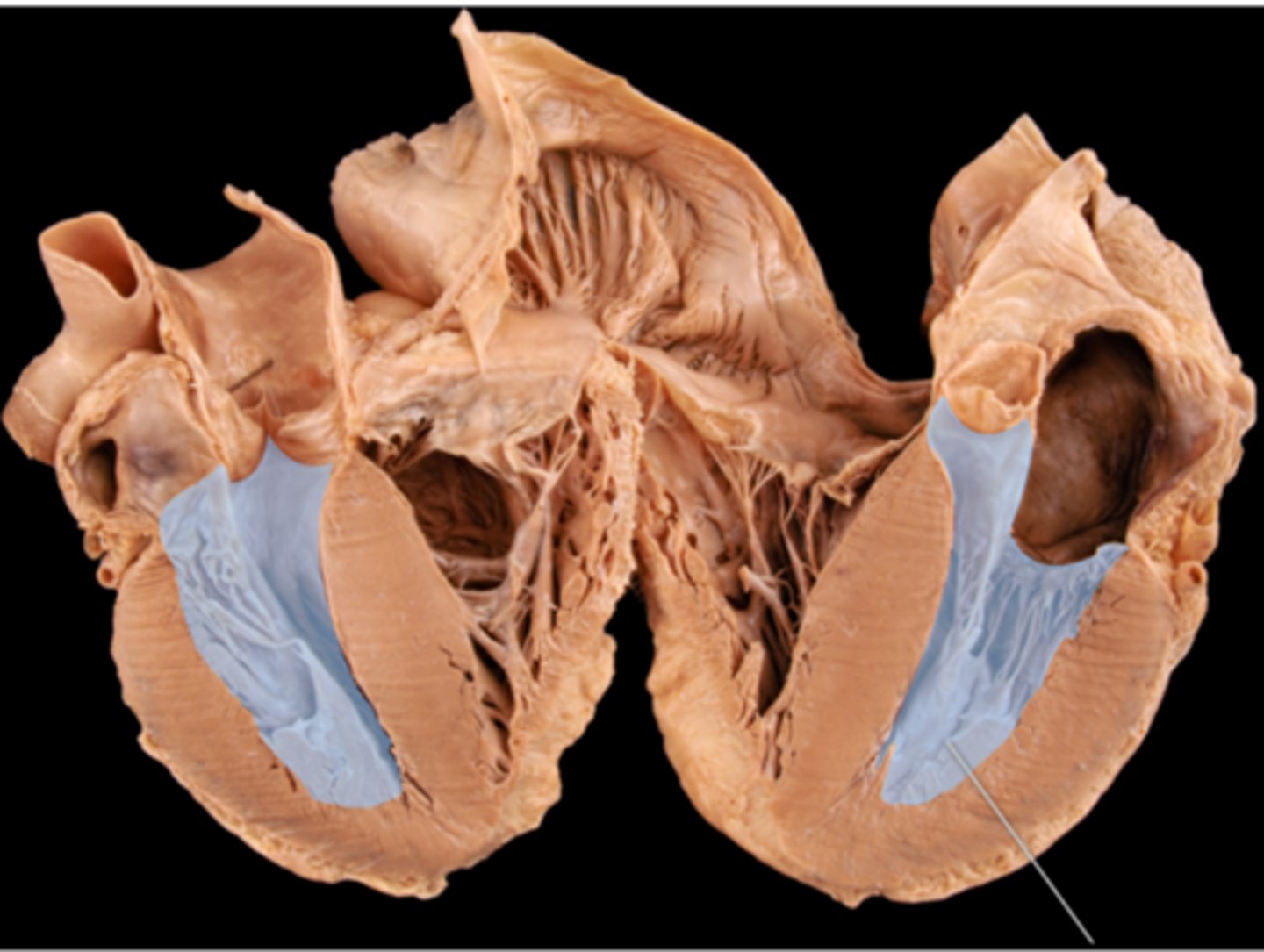 <p>left ventricle</p>