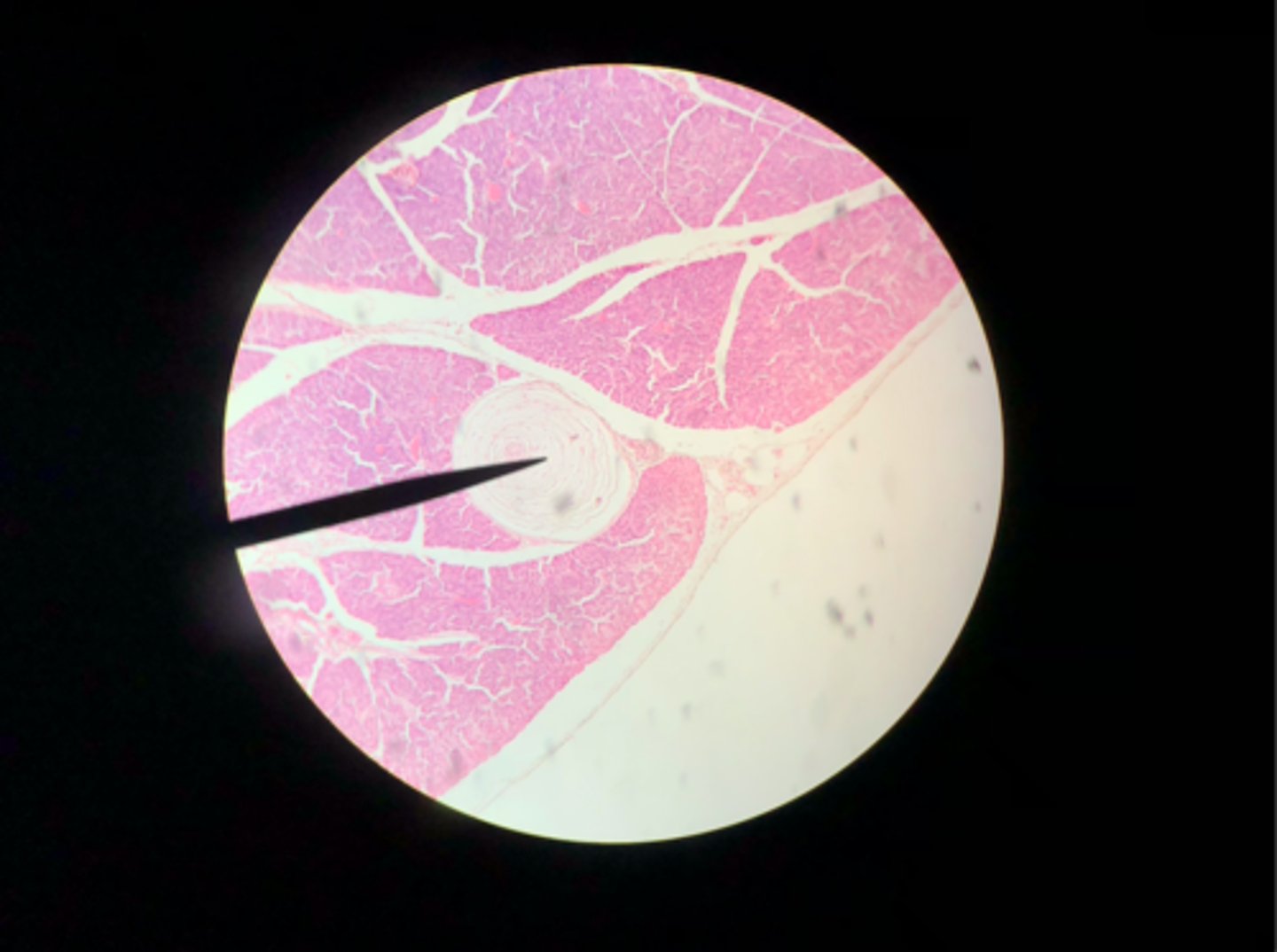 <p>What sensory structure is the pointer placed on?</p>