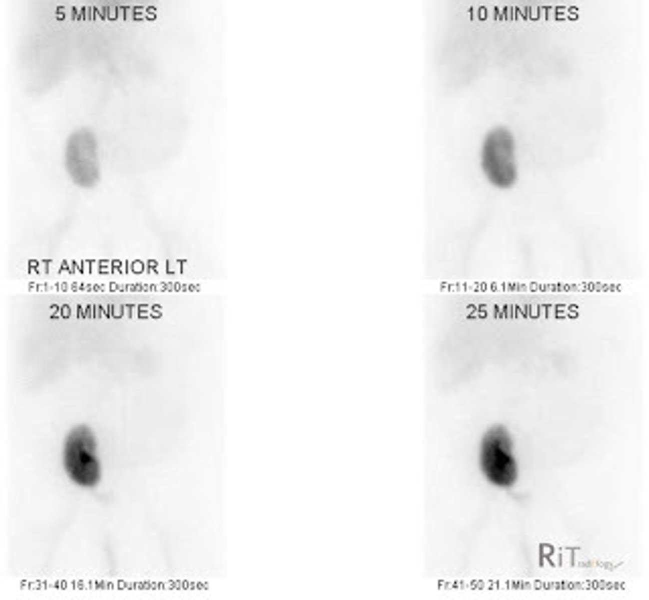 <p>Kidney absorbs 99m-Tc &amp; is cleared by filtration</p>