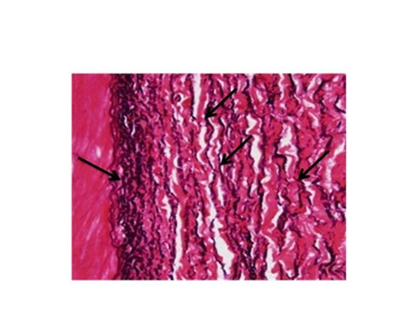 <p>elastic fibers: fuscia<br>collagen fibers: green</p>