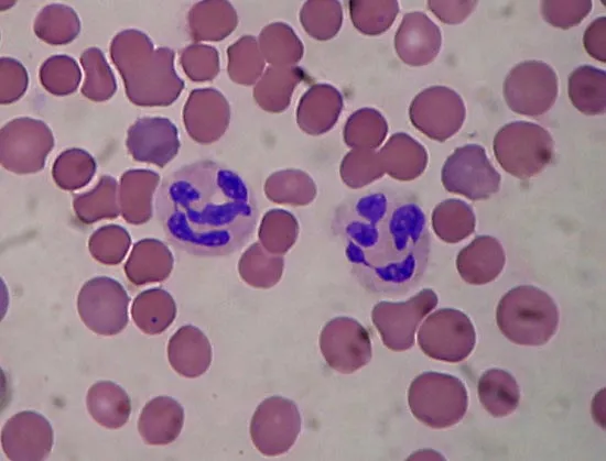 <p>What type of WBC is this? </p>