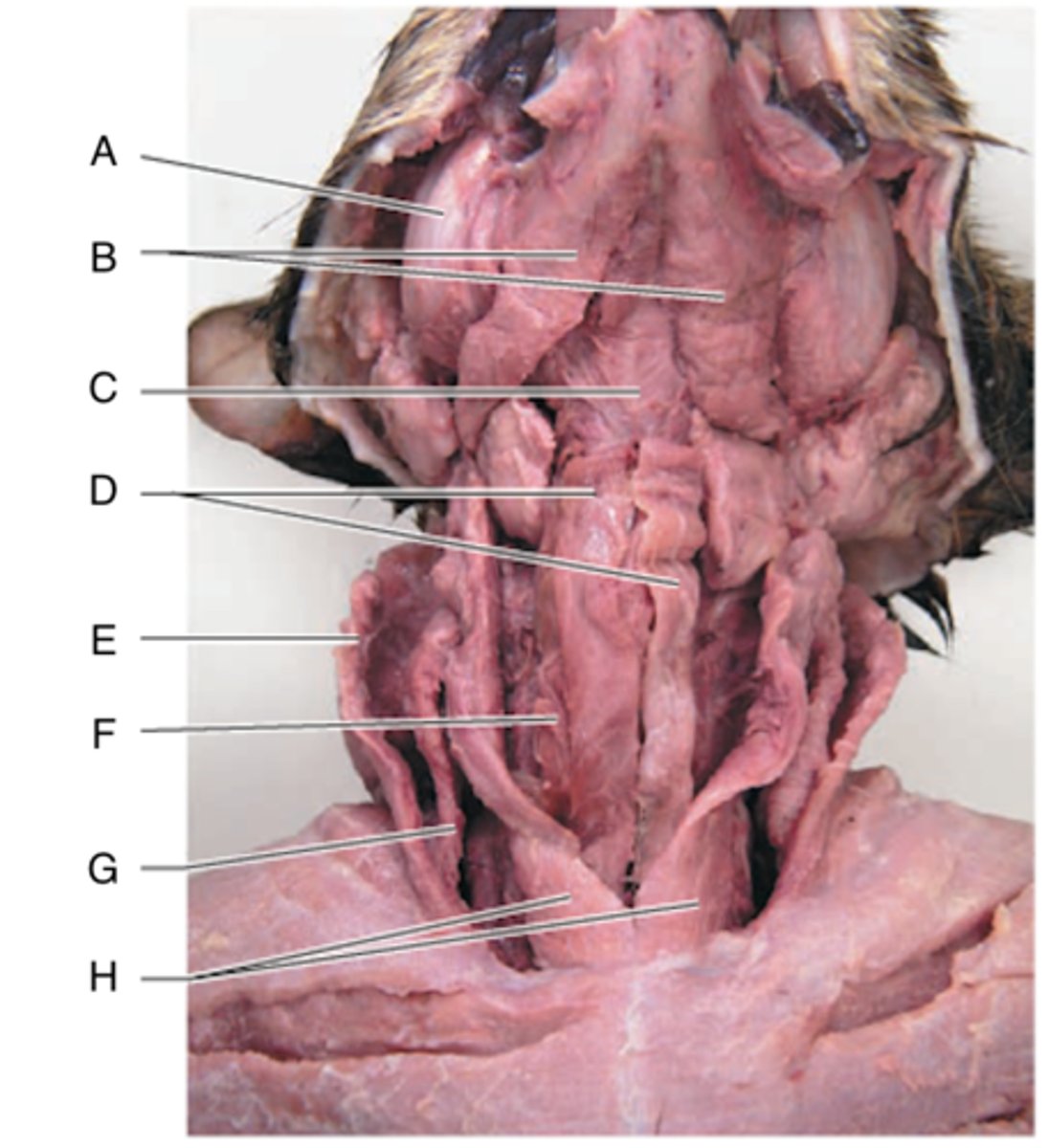 <p>What is the muscle indicated by letter H? What is an attachment point and function?</p>