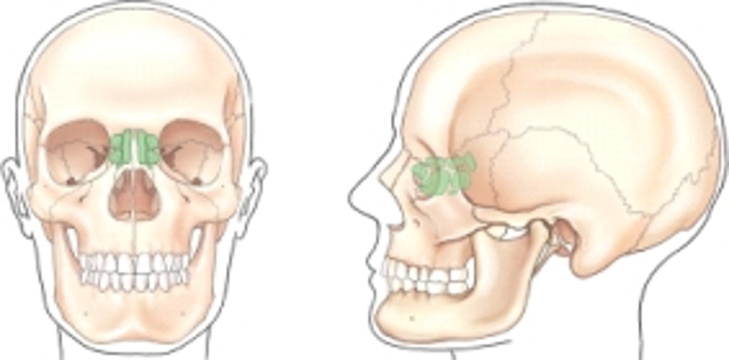 <p>C) Ethmoid</p><p>pg. 396: fig. 11.61</p>