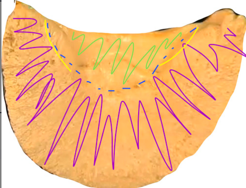 this is the sole of the distal phalanx. the surface in green is called...
