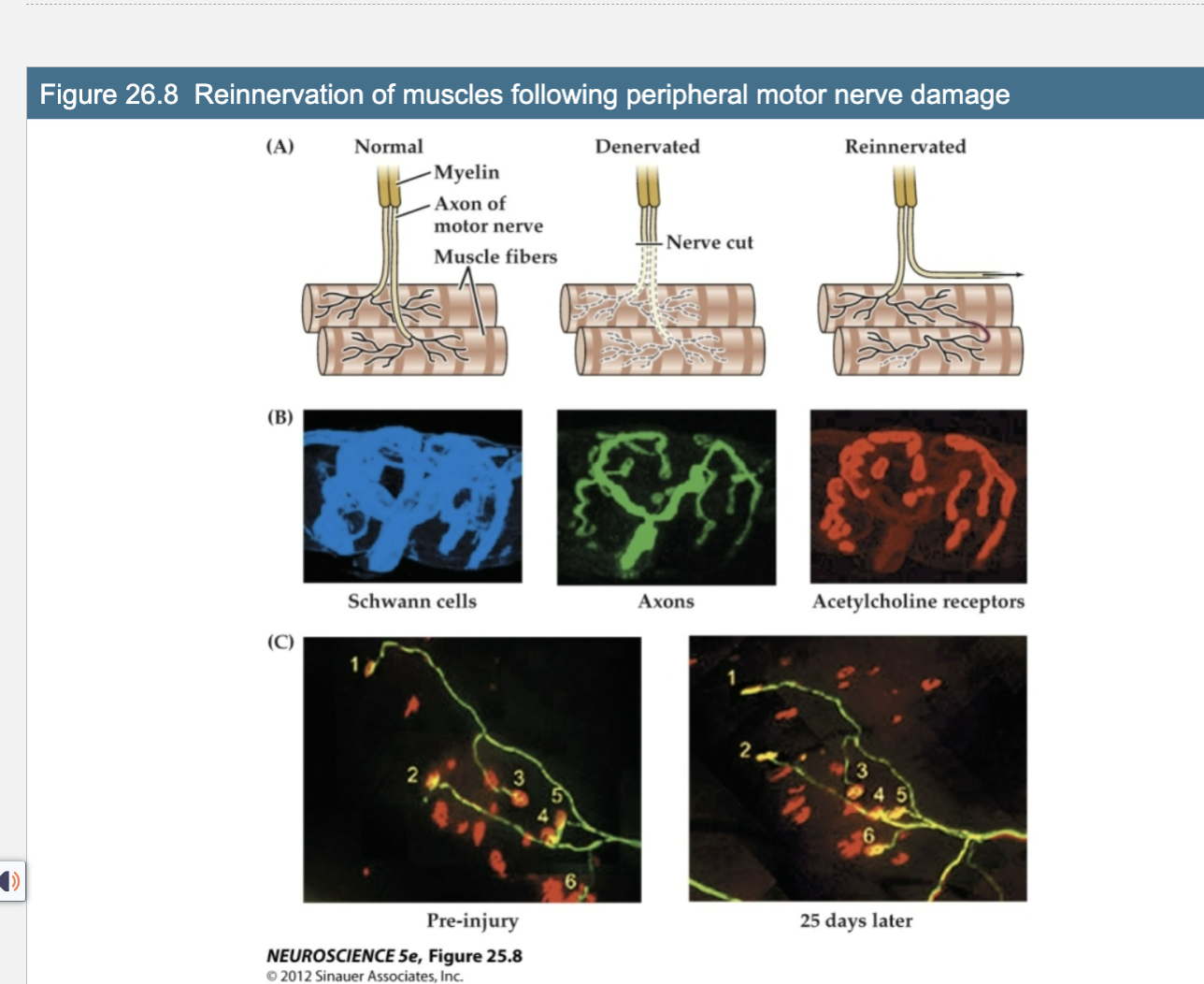 <p>Figure 26.8 Reinnervation of muscles following peripheral motor nerve damage</p>