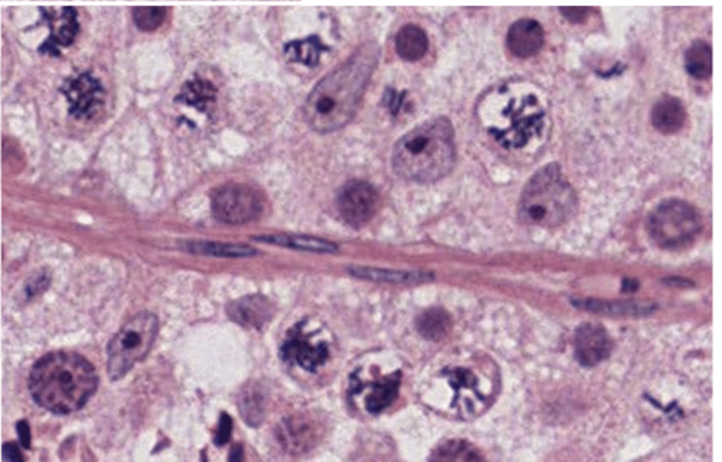 <p>What type of tissue and cell?</p>