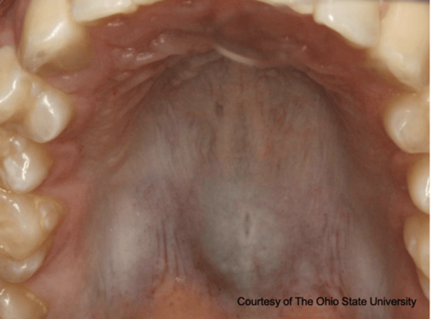<p>What type of pigmented lesion?</p>