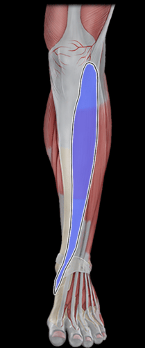 <p>What Muscle Is Highlighted?</p>
