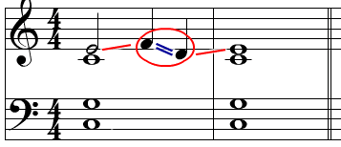 <p>When a chord tone is decorated by both an upper and a lower neighbor tone before returning to the original chord tone</p>