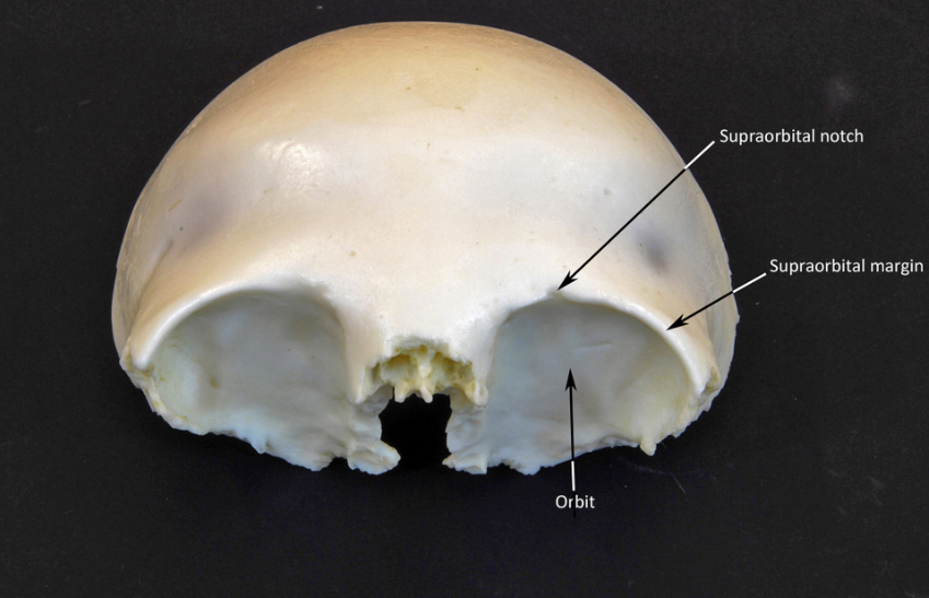 <p>Superior rim of orbit to protect eye </p>