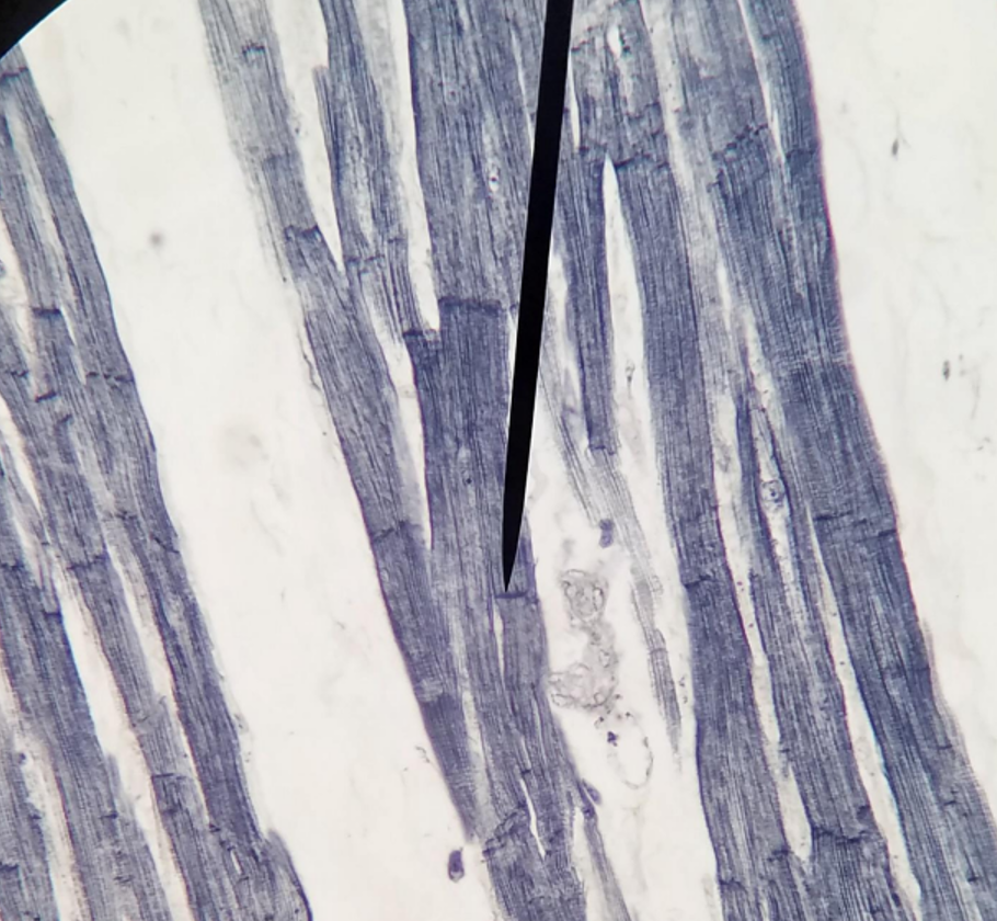 <p>What muscle is this?</p>