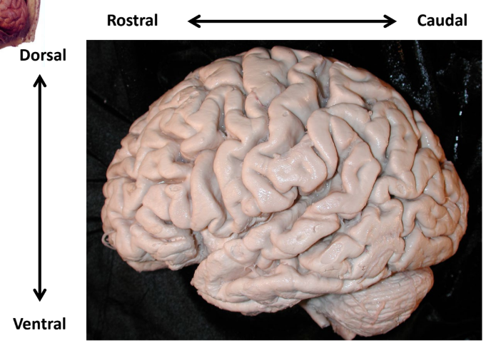 <p>Orientation of the Human Brain</p>