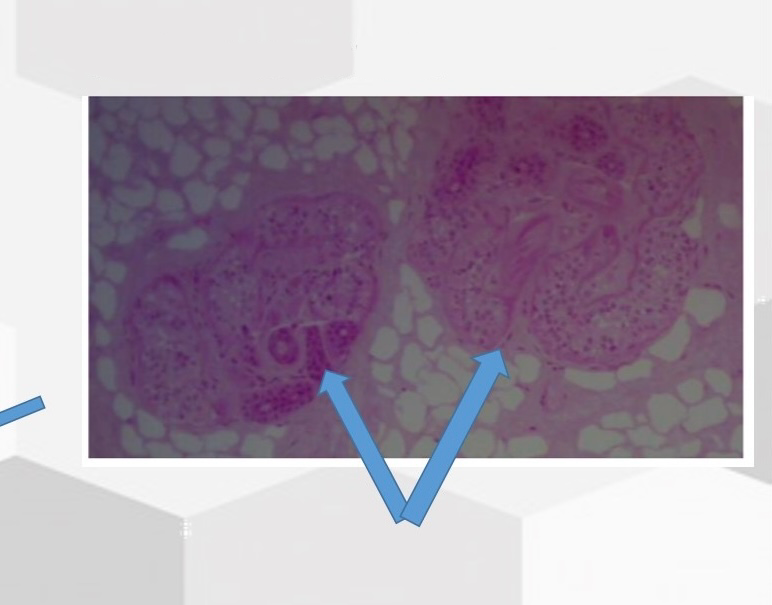 <p>Name this gland</p>