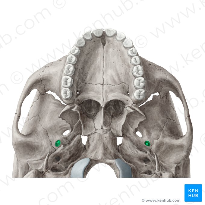 <p>What hole in the <strong>greater wing of sphenoid</strong> is this?</p>