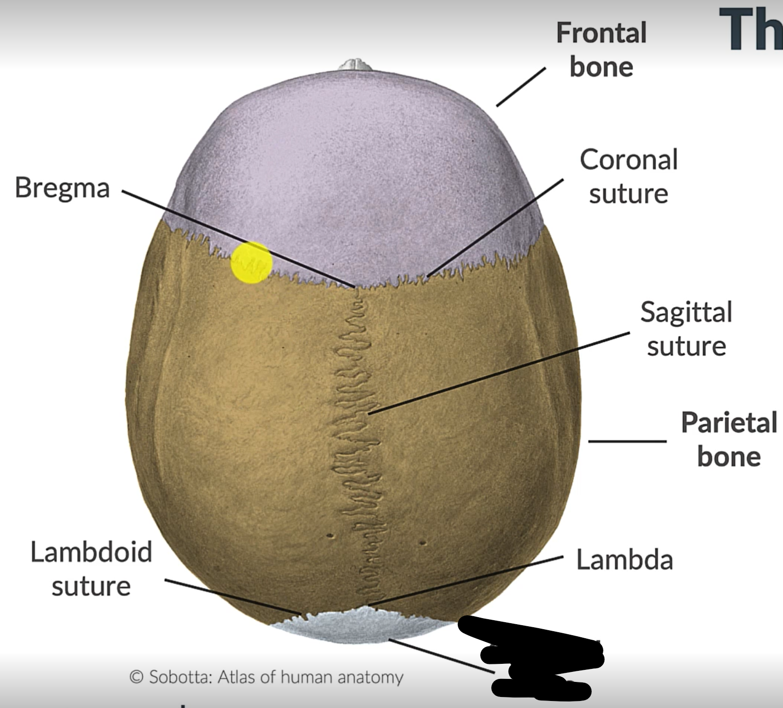 term image