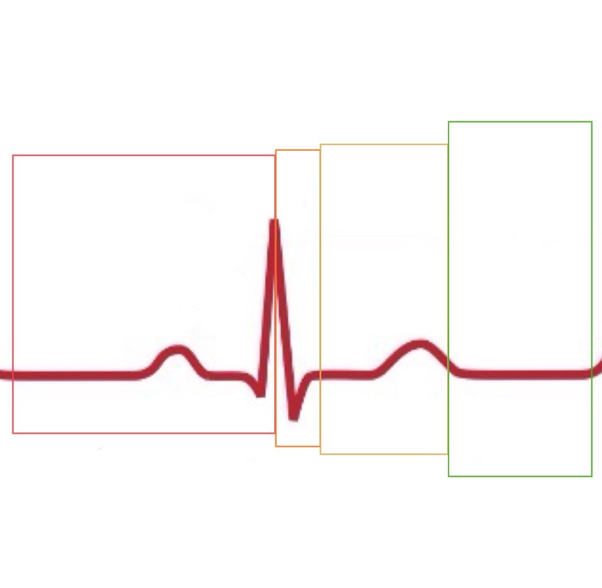 <p>What cardiac cycle phase is happening in the yellow box of the EKG graph?</p>