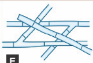 <p>Name the <strong>Type of Hyphae</strong></p>