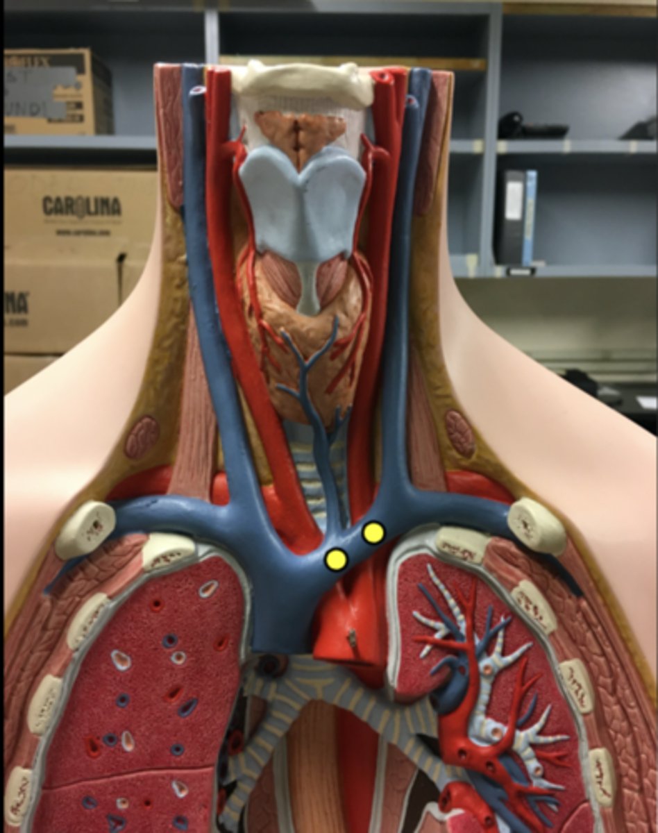 <p>**UPDATED PICTURE**</p>