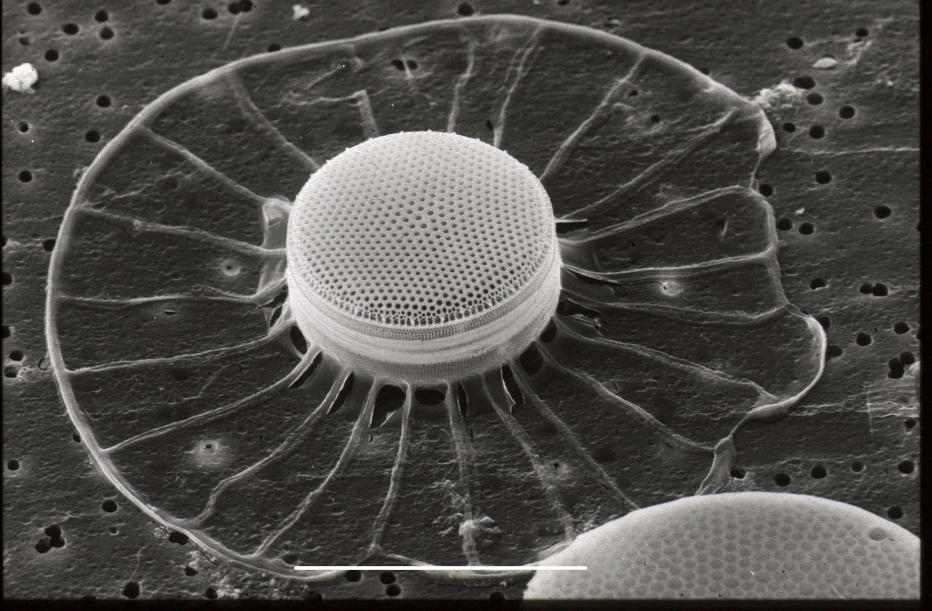 Electron microscopy of a diatom