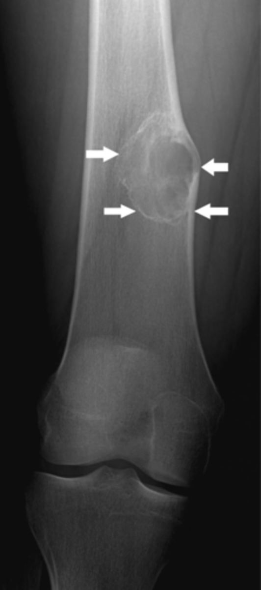 <p>What are the white arrows pointing to?</p>
