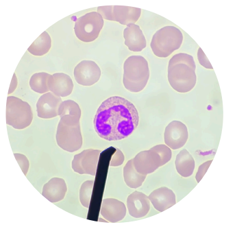<p>what kind of white blood cells is this?</p>