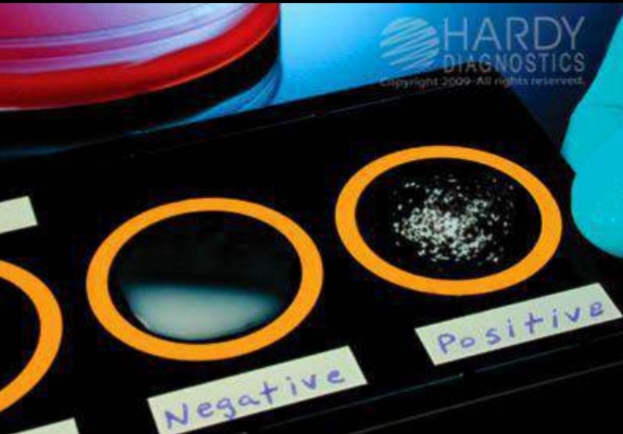<ol><li><p>Name the test </p></li><li><p>The result of the reaction seen as ….</p></li><li><p>the Ag in this reaction is present in particulate form is called ……</p></li><li><p>The Ab in this reaction is called….</p></li><li><p>The test is used for …..</p></li></ol>