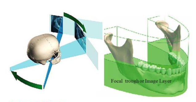 <p>Ghost images/artifacting is created when that object is OUTSIDE of the zone of focus/image layer </p>