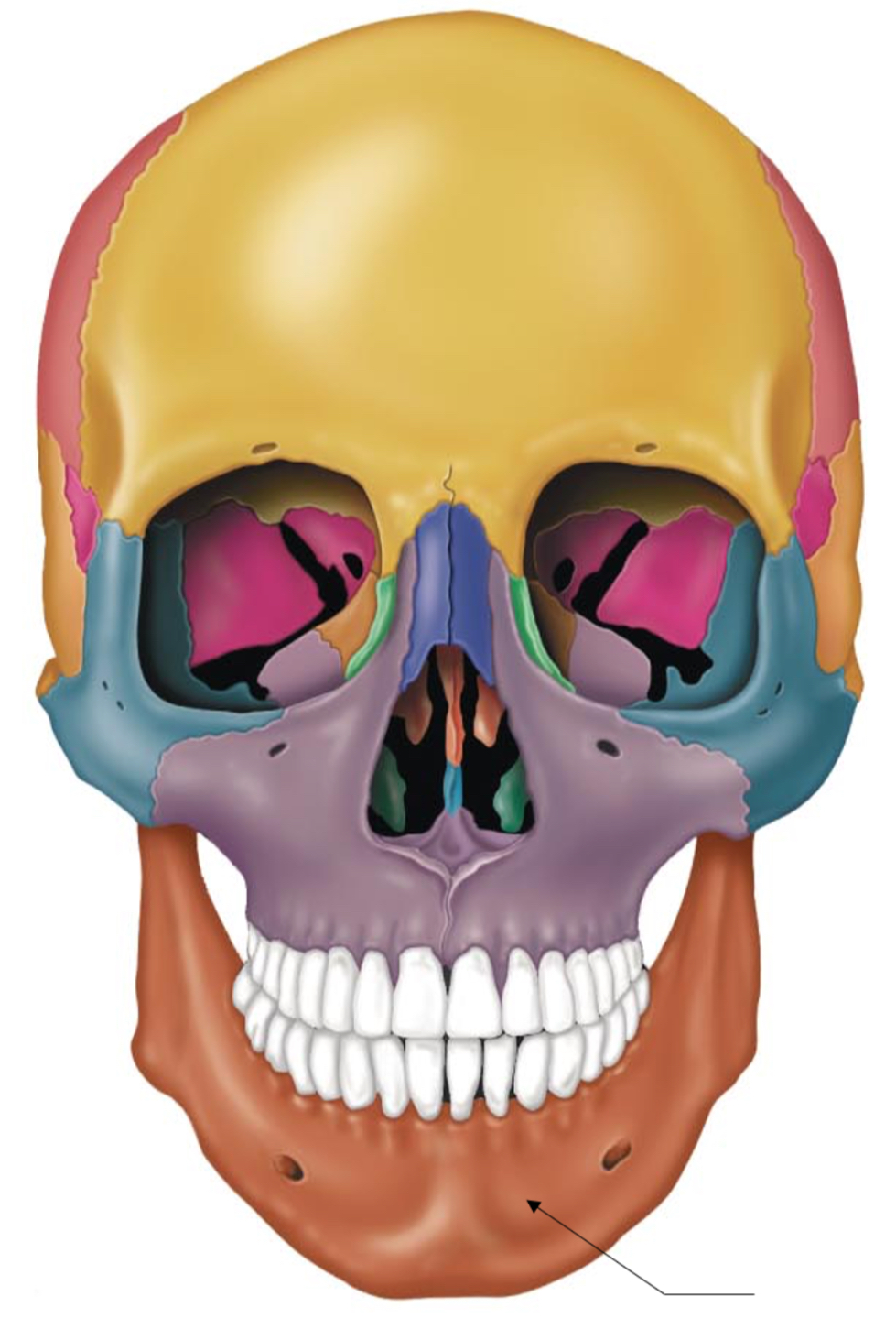 term image