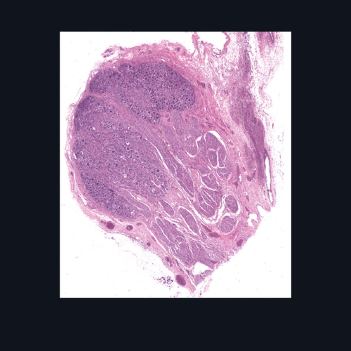 <p>Identify the specific structure given in the image, as well as the type of tissue predominating in the structure.</p>