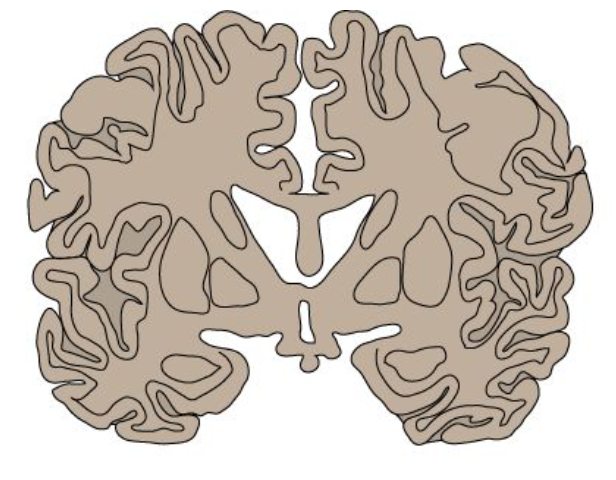 <p>what type of section is this?</p>
