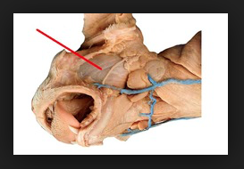 <p>What is the muscle indicated by the red line? What is an attachment point and function?</p>