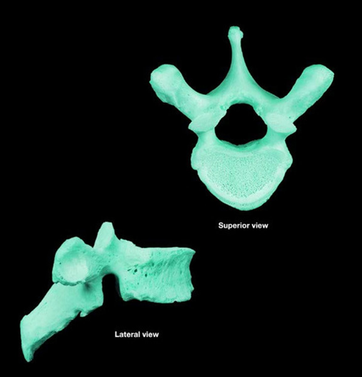 <p>Vertebra that are characterized by long spinous processes and costal articulations</p>