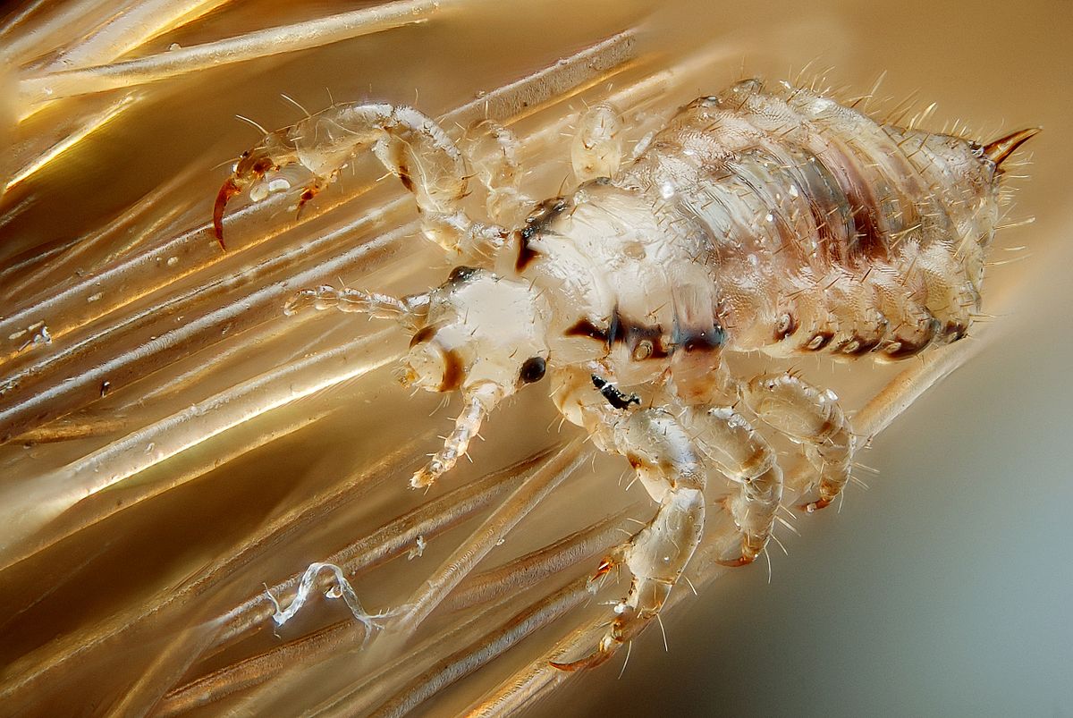 <p>Lice</p>