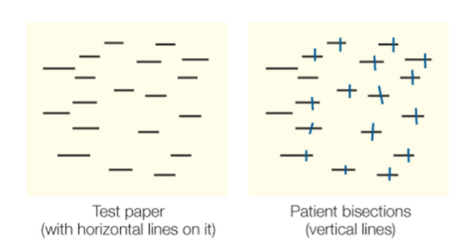 <ul><li><p>test paper (with horizontal lines on it)</p></li><li><p>test this by having patients intersect the lines</p></li><li><p>can see in this image the patient left some of the lines on the left completely empty  and even within the line it is not on the center it is more towards the right</p></li></ul><p></p>