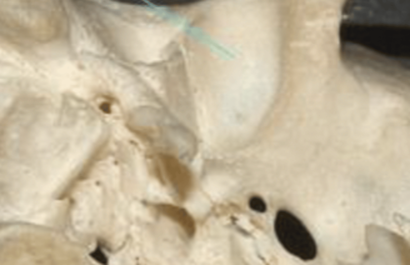 <p>mandibular fossa</p>