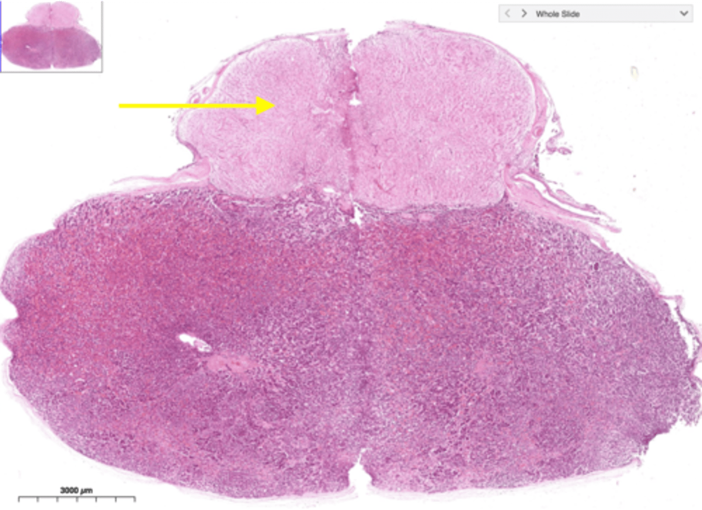 <p>Composed of neural tissue; stores and secretes oxytocin and ADH produced by the hypothalamus.</p>