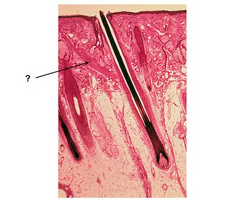 <p>small muscle in the skin attached to hair follicles. When it contracts, it causes the hair to stand on end, a phenomenon known as "goosebumps".</p>