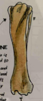 <p>only head and shaft of fibula are well-developed</p>