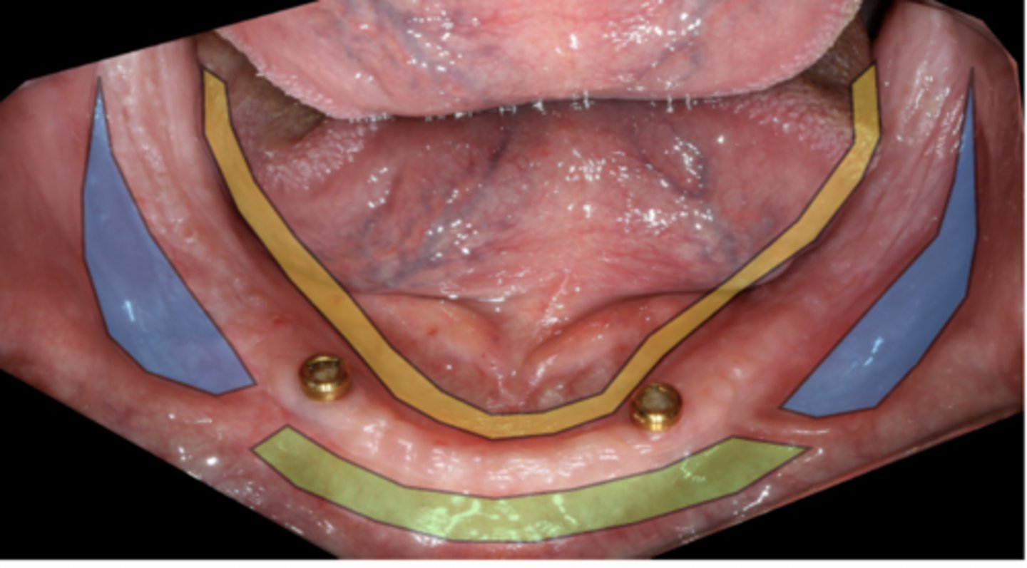 <p>ID the region in blue:</p>