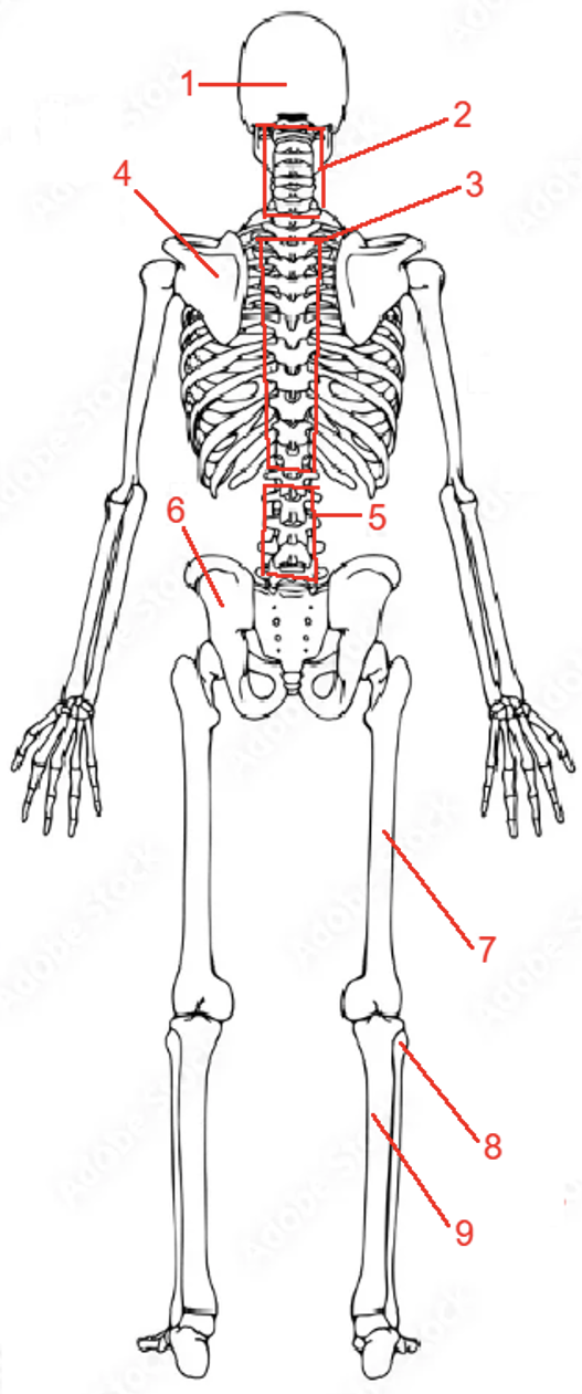 <p>Label items <strong>1-4.</strong></p>